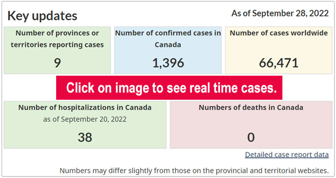 Monkeypox statistics